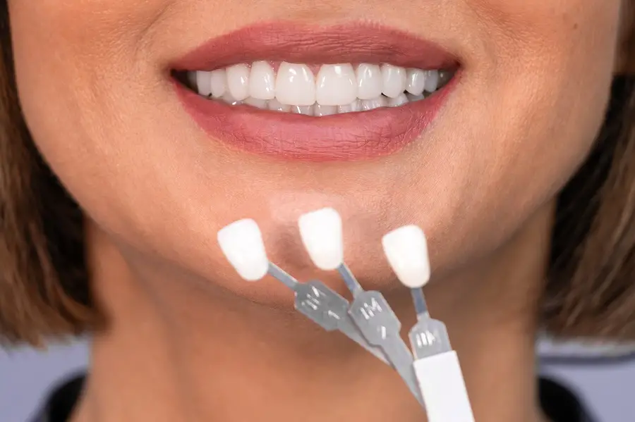 5 Most Popular Cosmetic Dentistry Services